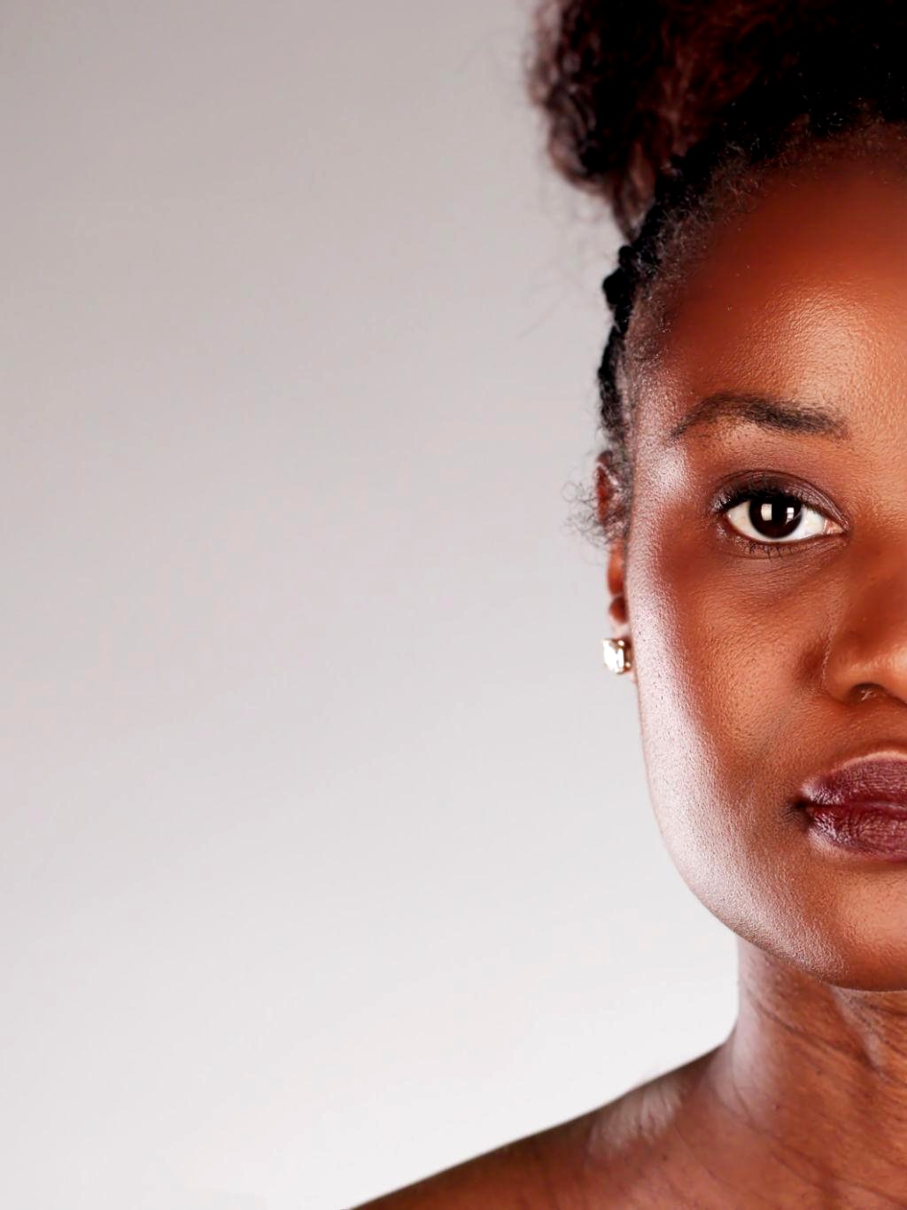 Nompumelelo D. LED Skin Rejuvenation result โ after